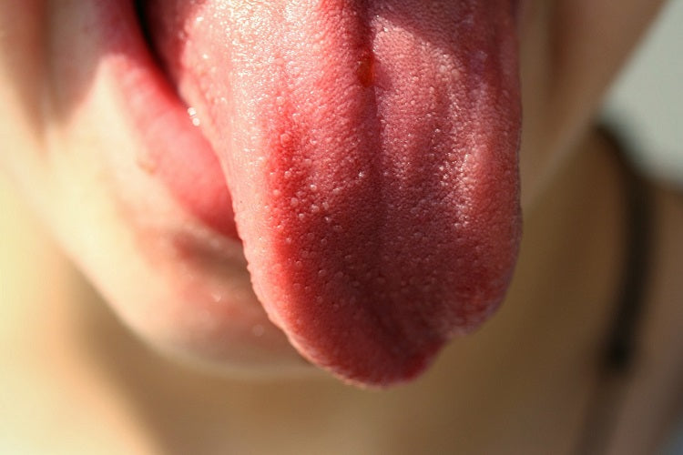 Vaper's Tongue: Causes and Treatments | Aquavape | Vaping Guides Vaper's Tongue: Causes and Treatments | Aquavape | Vaping Guides